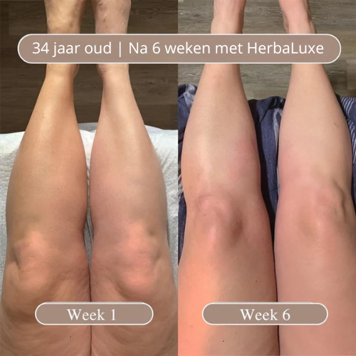 HerbaLuxe Anti-Cellulite Massage Oil