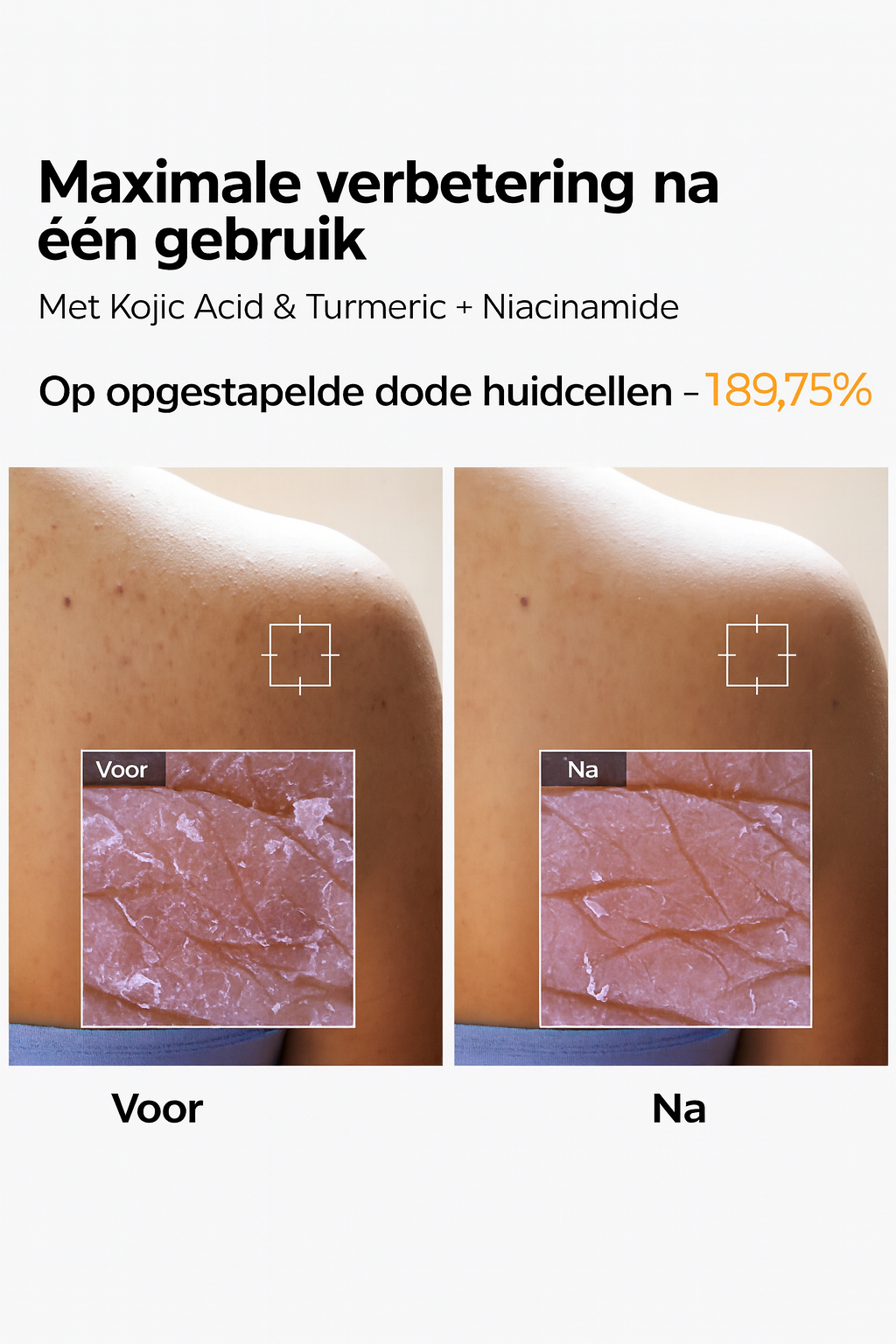 Peel Shot Exfoliatie Spray