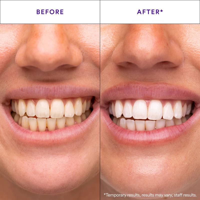 V34 Colour-Correct Whitening Strips