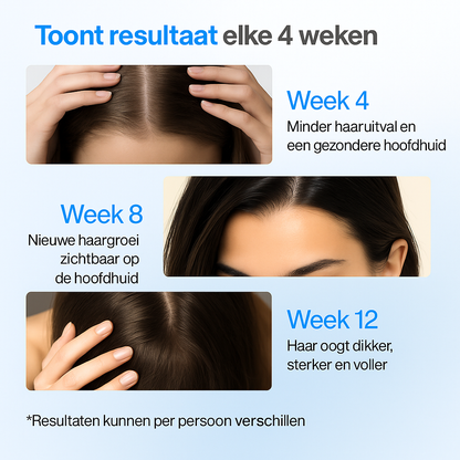 Bodywise Hair Growth Serum Roll-On