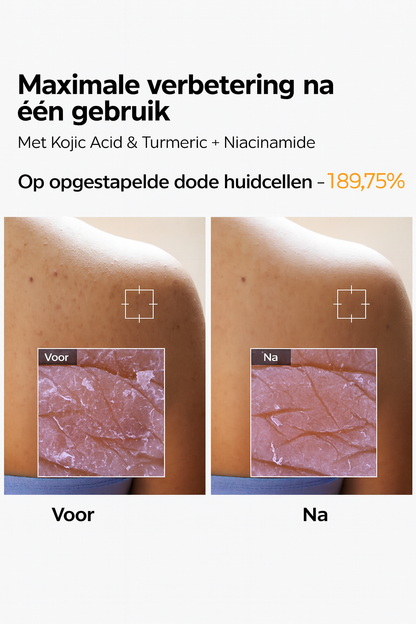 Peel Shot Exfoliatie Spray